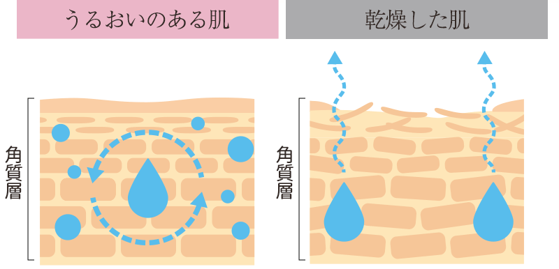 うるおいのある肌と乾燥した肌